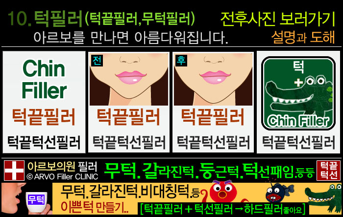 턱끝필러,비대칭턱끝교정,브이라인,턱끝필러,브이라인필러,브이라인턱필러,턱필러,브이라인턱