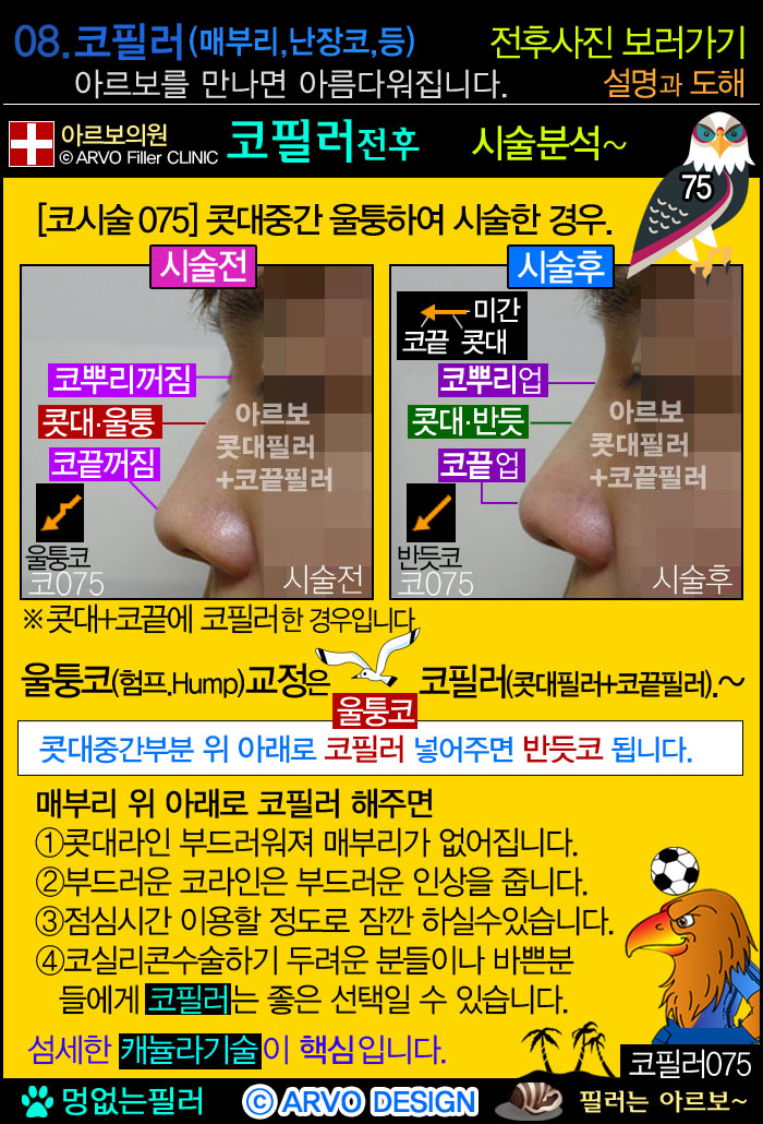 앞광대필러,광대앞필러,인형광대필러,광대필러