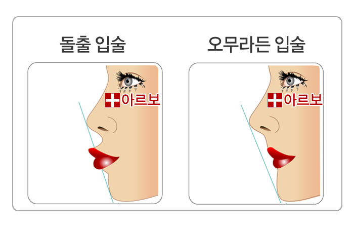µ¹ÃâÀÔ¼ú,¿À¹«¶óµçÀÔ¼ú,µ¹ÃâÀÔ,¿À¹«¶óµçÀÔ,µ¹ÃâÀÔ°ü»ó,µ¹ÃâÀÔ¼ú°ü»ó,ÀÔ¼ú°ü»ó,ÀÔ°ü»ó,¿À¹«¶óµçÀÔ¼ú°ü»ó,¿À¹«¶óµçÀÔ°ü»ó