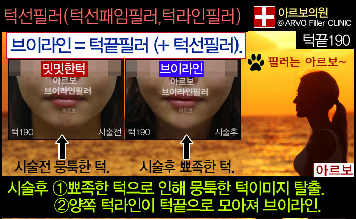 γʷ,̶,,,μʷ