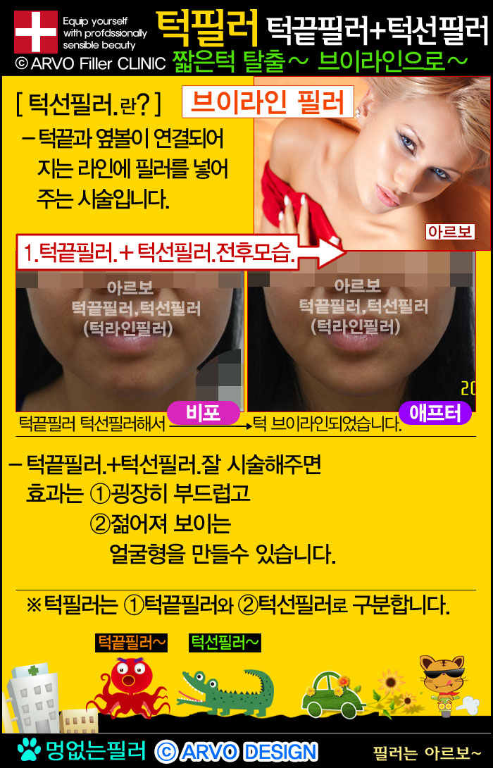 브이라인턱필러,브이턱필러,턱끝필러,턱선필러,브이라인,턱필러,동안턱필러,턱라인브이라인턱