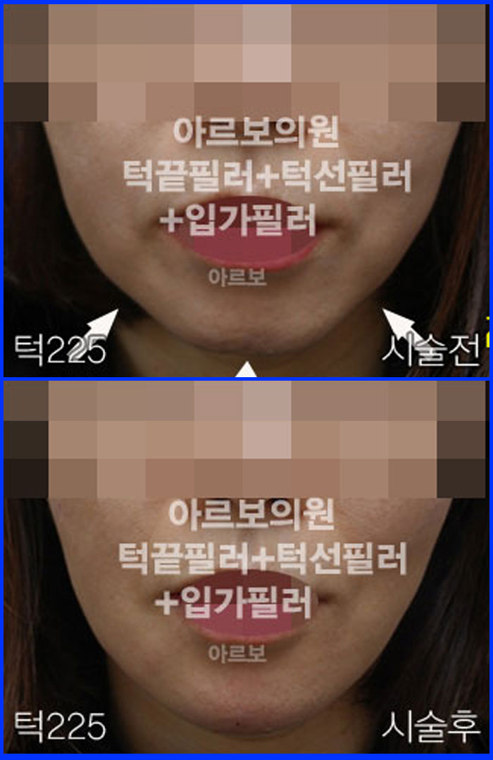 ʷ,ͺʷ,Įʷ,Ƹǿ