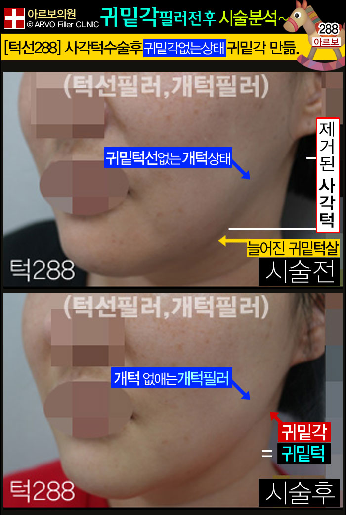 μʷ,μʷ,ζʷ,簢μʷ,ʷ,͹ʷ,簢μʷ