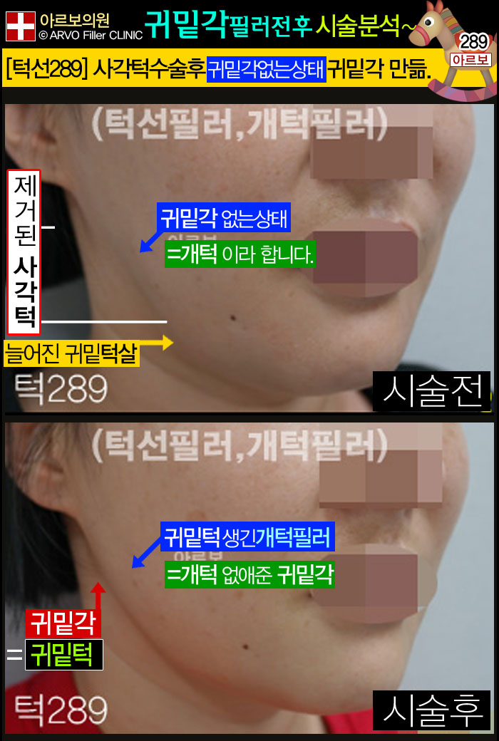 μʷ,μʷ,ζʷ,簢μʷ,ʷ,͹ʷ,簢μʷ