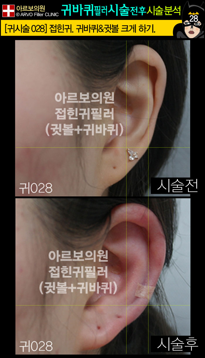 ���ʷ�,�ͺ��ʷ�,Į���ʷ�,�Ƹ����ǿ�