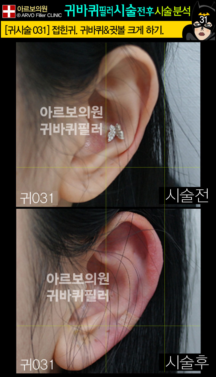 �������ʷ�,������ʷ�,���ʷ�,�ͺ��ʷ�,Į���ʷ�,�Ƹ����ǿ�