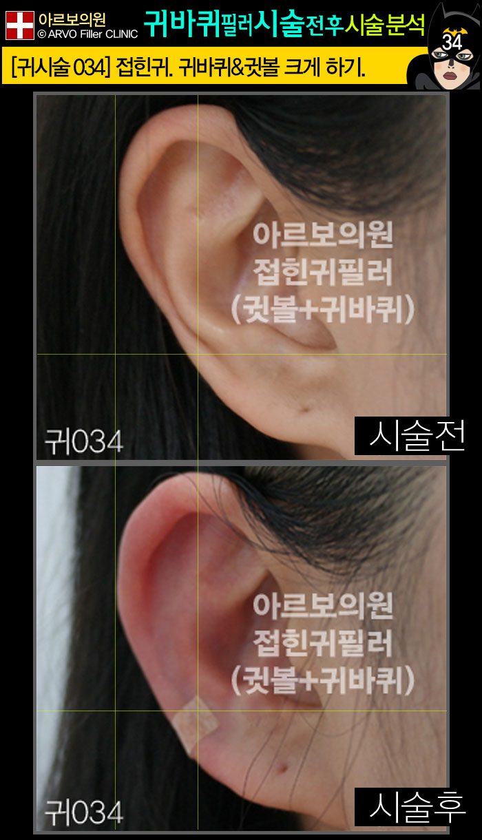 ���ʷ�,�ͺ��ʷ�,Į���ʷ�,�����,������,�Ƹ����ǿ�