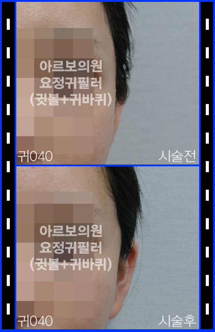 ±ÍÇÊ·¯,±Íº¼ÇÊ·¯,Ä®±ÍÇÊ·¯,¾Æ¸£º¸ÀÇ¿ø