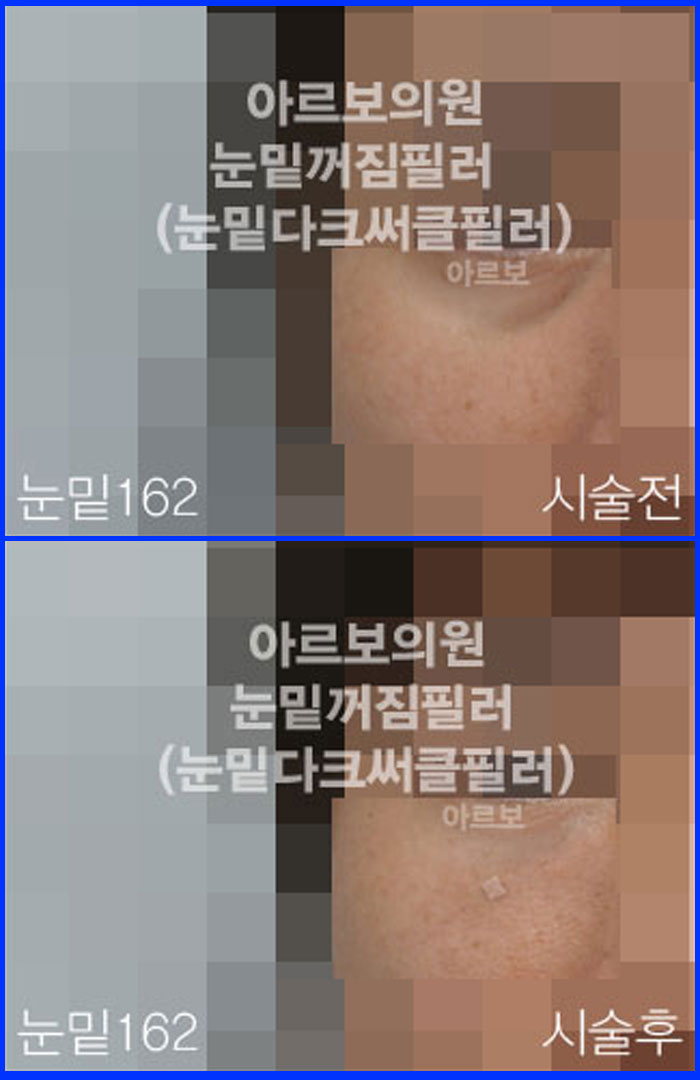 ʷ,ز,ũŬ