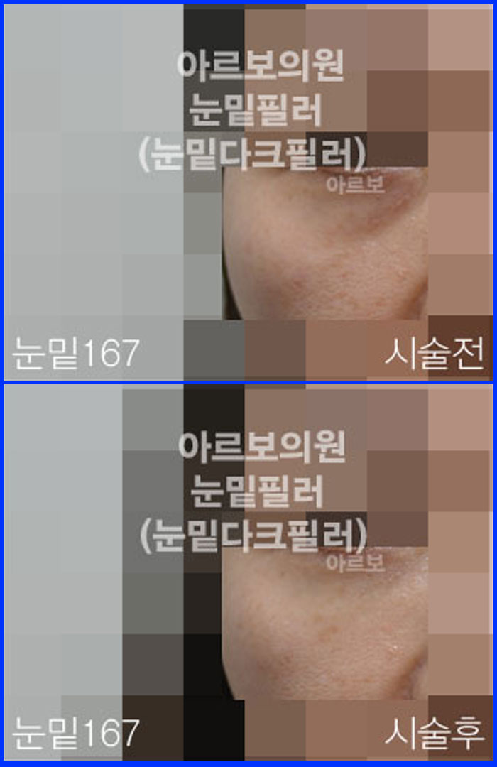 ʷ,ز,ũŬ