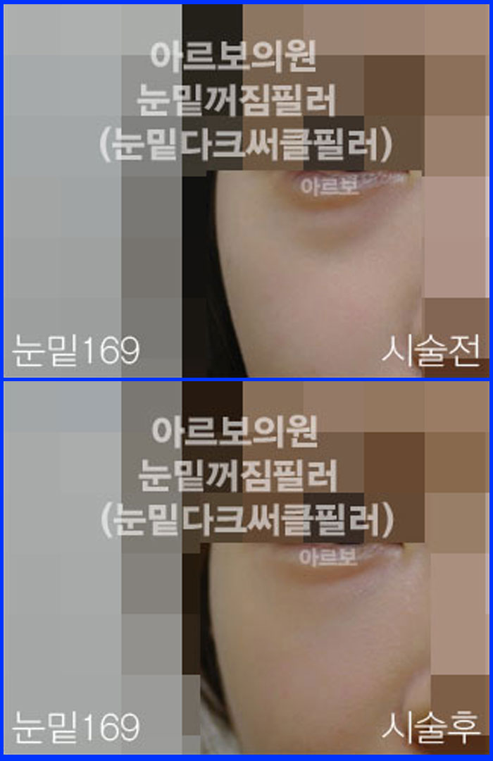 ʷ,ز,ũŬ