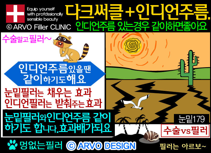 눈밑필러인디언필러,눈밑꺼짐원인,다크써클,눈밑꺼짐,눈밑필러,눈밑수술,하안검수술,눈밑꺼짐필러