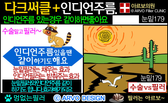 눈밑필러인디언필러,눈밑꺼짐원인,다크써클,눈밑꺼짐,눈밑필러,눈밑수술,하안검수술,눈밑꺼짐필러