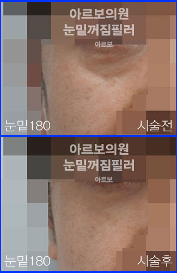 ʷ,ز,ũŬ