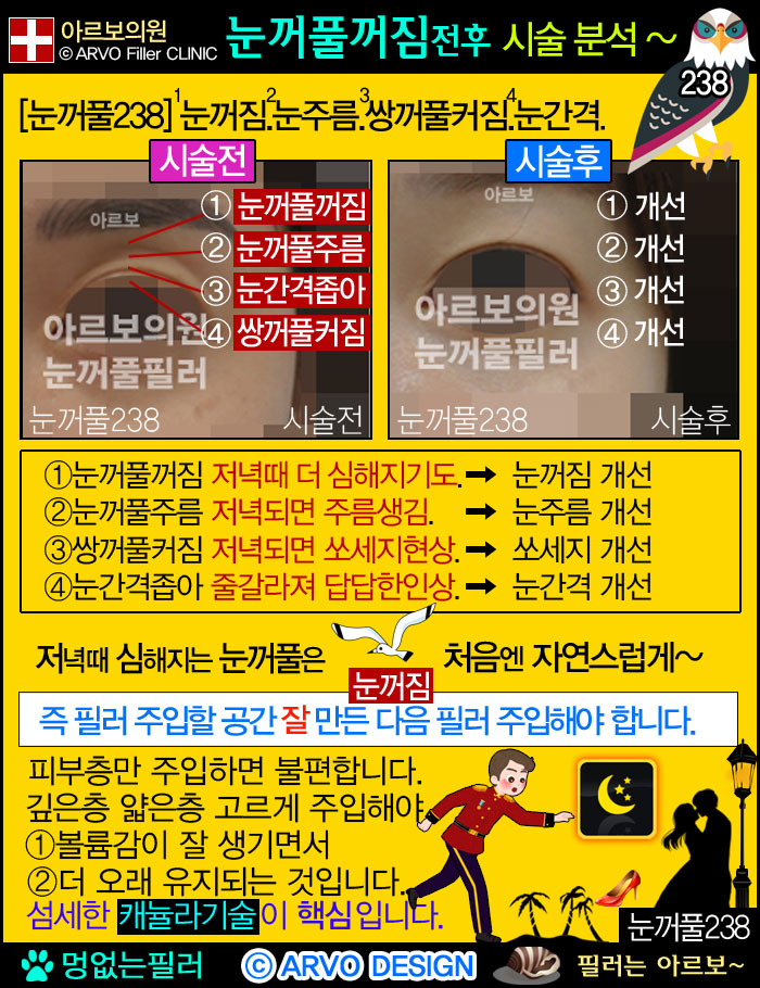 눈꺼풀필러,눈두덩필러,좁은눈필러,눈주름필러,이중쌍꺼풀필러