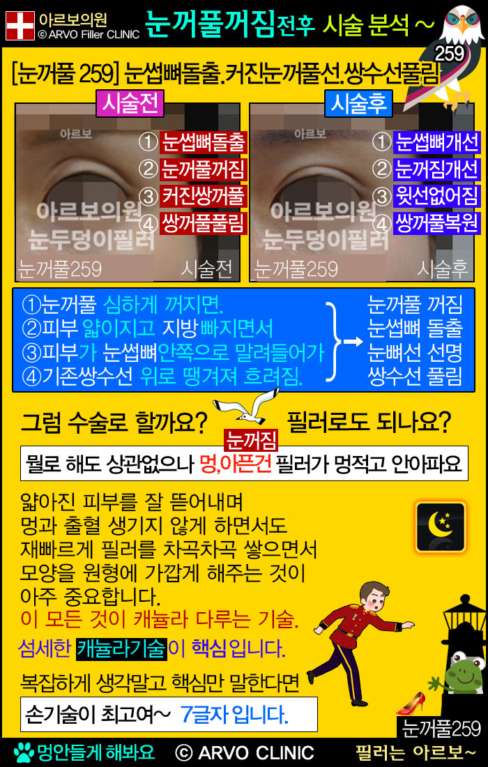 �������ʷ����Ļ���