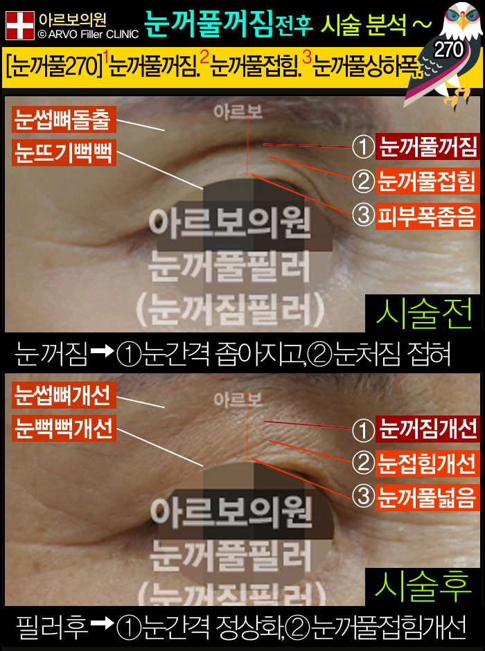 Ǯʷ,ʷ,Ǯʷ,εʷ,Ƹǿ