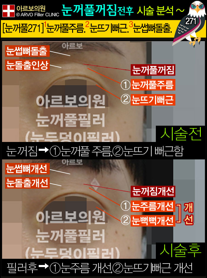 Ǯʷ,ʷ,Ǯʷ,εʷ,Ƹǿ