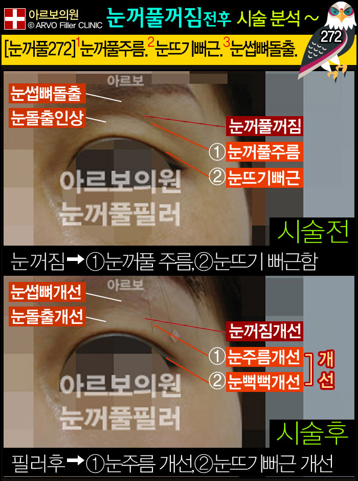 ��������Ǯ�ʷ�,���������ʷ�,����Ǯ�ʷ�,���ε��ʷ�,�Ƹ����ǿ�