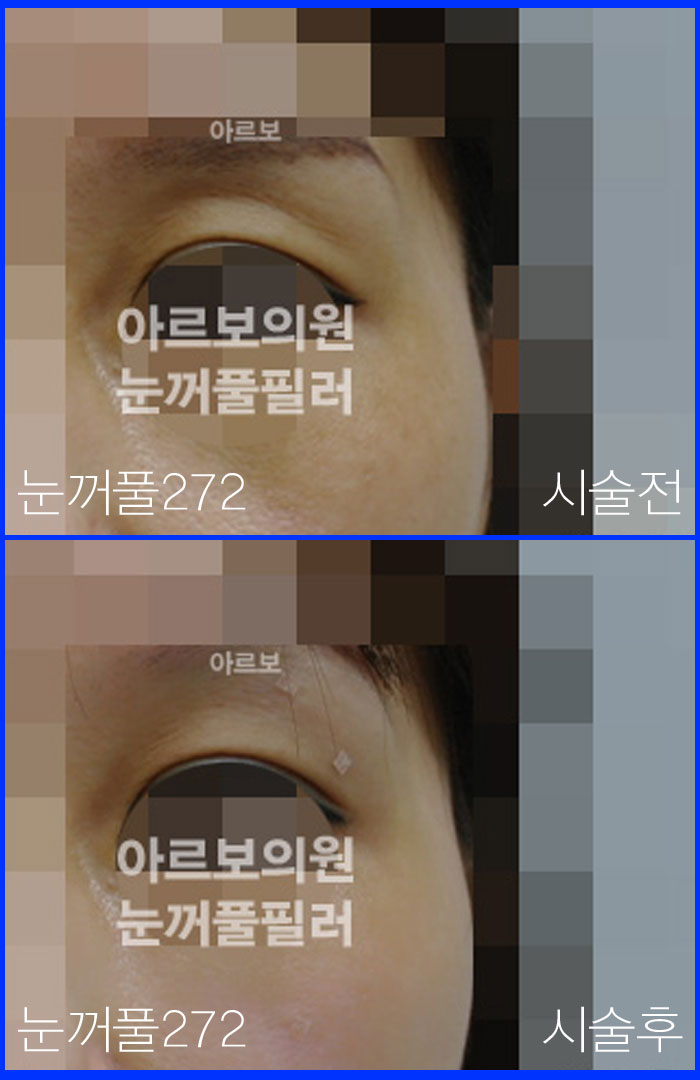 ´«²¨ÁüÇÊ·¯ÀüÈÄ»çÁø,´«µÎµ¢ÇÊ·¯ÀüÈÄ,´«²¨Ç®ÇÊ·¯ÀüÈÄ»çÁø