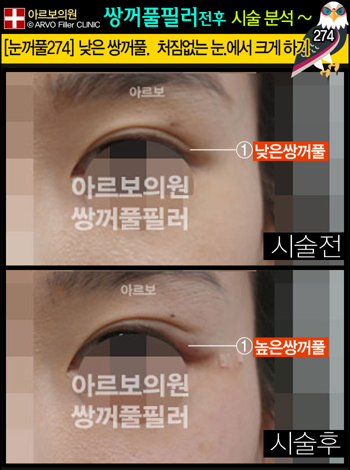 ����Ǯ�ʷ�,�Ƹ����ǿ�,�ֲ�Ǯũ��