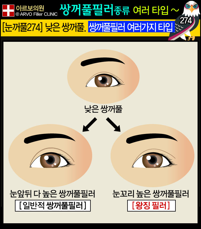 ����Ǯ�ʷ�,�Ƹ����ǿ�,�ֲ�Ǯũ��