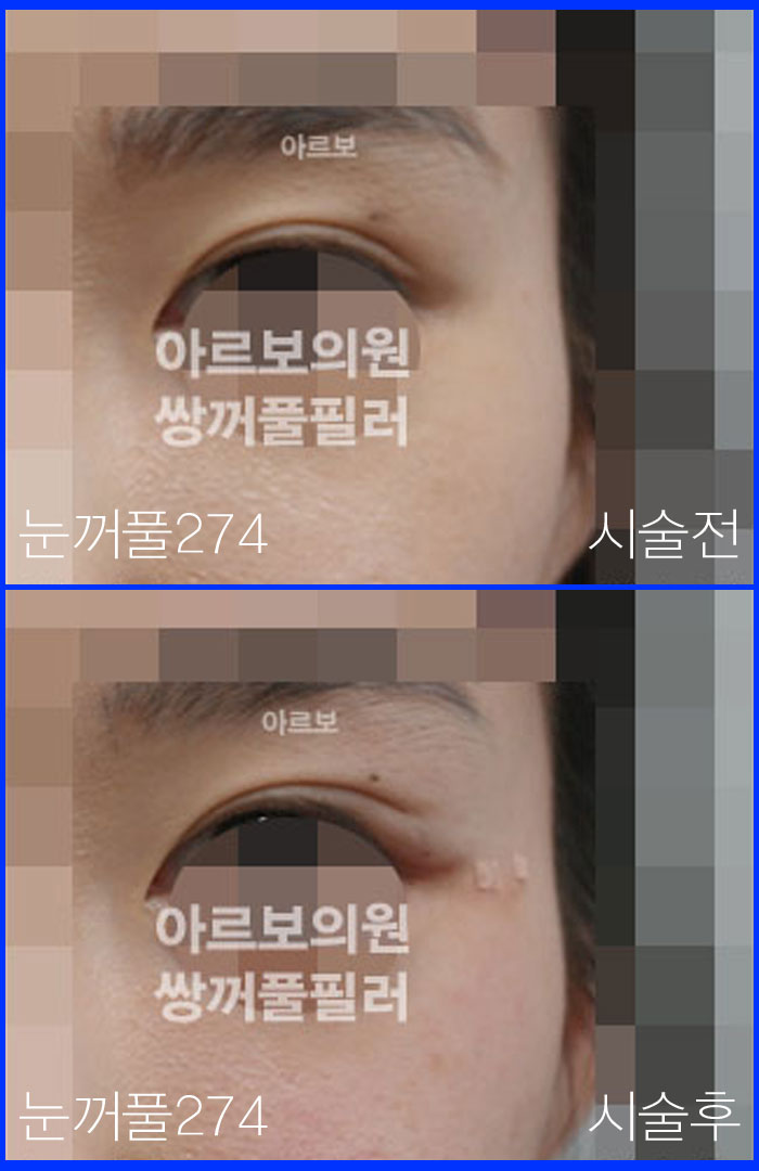 ����Ǯ�ʷ�,�Ƹ����ǿ�,�ֲ�Ǯũ��