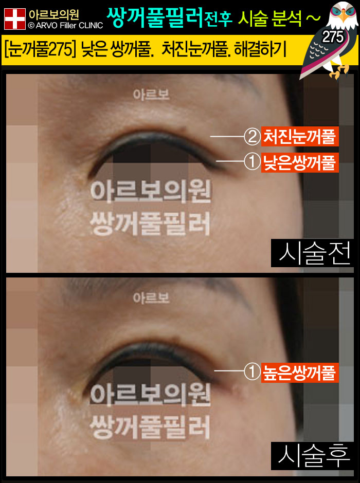 ����Ǯ�ʷ�,�Ƹ����ǿ�,�ֲ�Ǯũ��