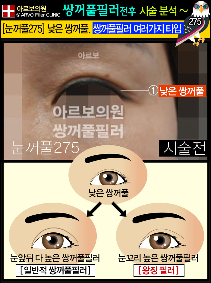 ����Ǯ�ʷ�,�Ƹ����ǿ�,�ֲ�Ǯũ��