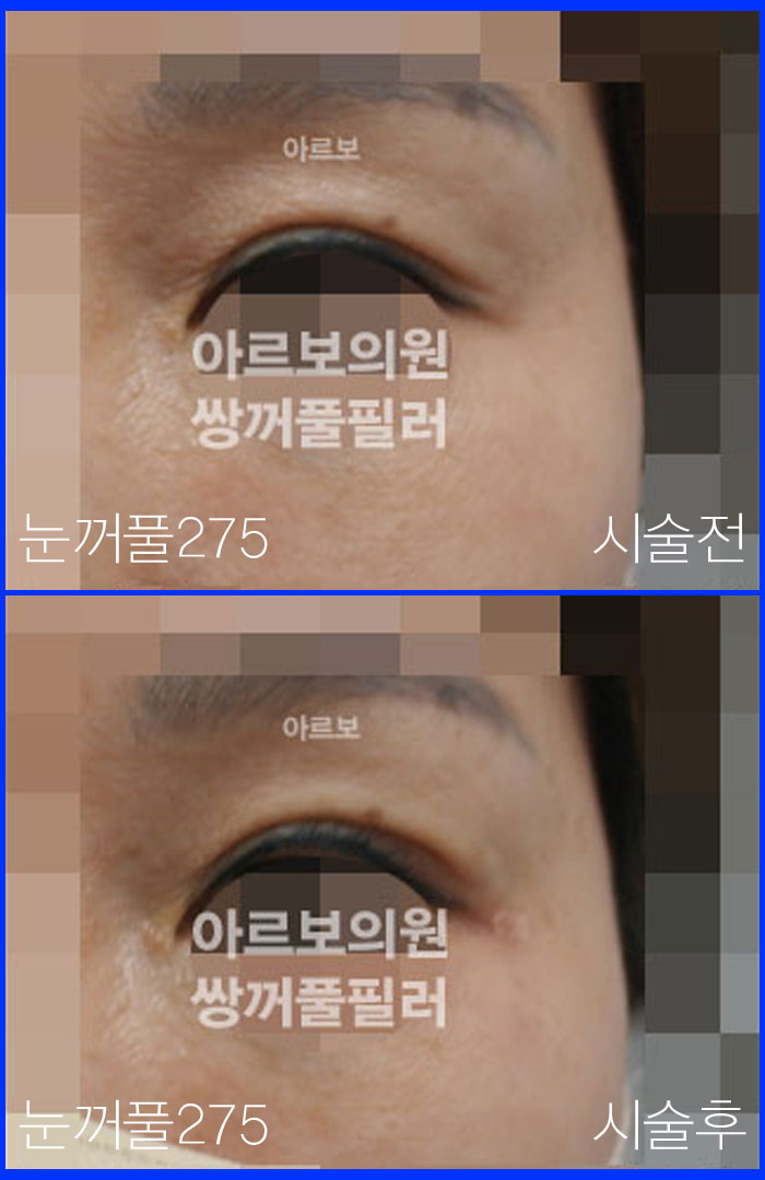 ����Ǯ�ʷ�,�Ƹ����ǿ�,�ֲ�Ǯũ��