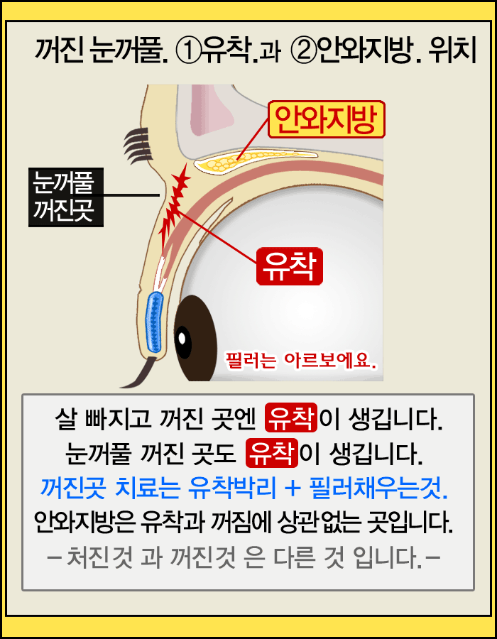 ����Ǯ�ʷ�,���ε��ʷ�,����Ǯ�ʷ�����,�Ƹ����ǿ�