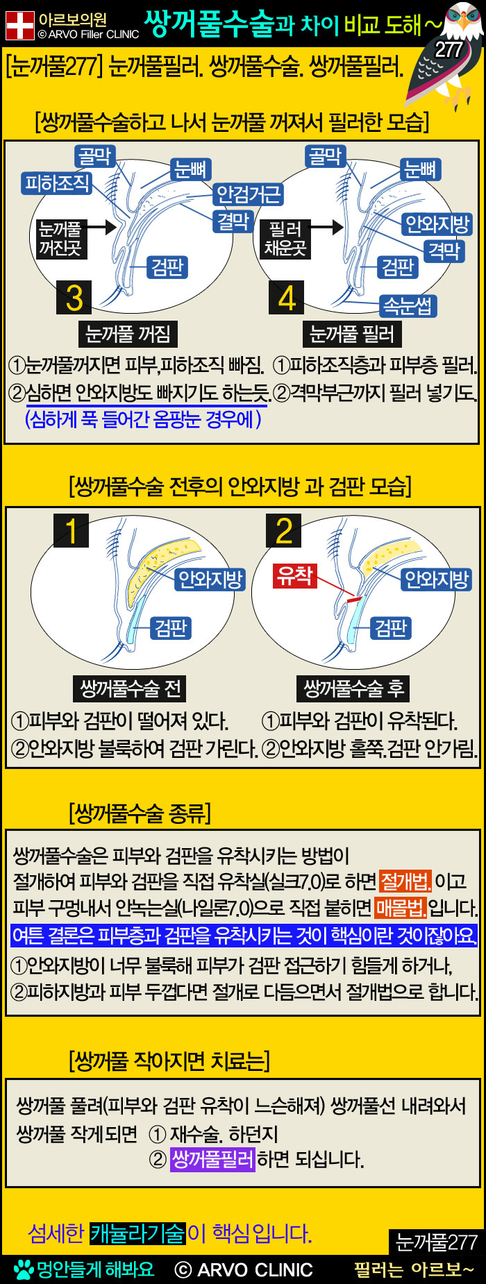 ����Ǯ�ʷ�,�ֲ�Ǯ��������,����Ǯ�ʷ�����,�Ƹ����ǿ�