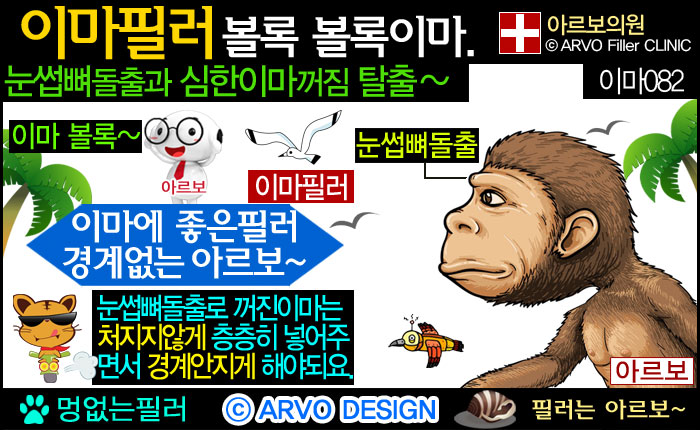 이마꺼짐,미간필러,미간꺼짐필러,이마함몰필러,이마꺼짐필러,이마필러