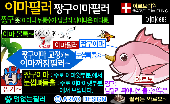 짱구이마,짱구이마필러,눈썹뼈돌출이마,눈썹뼈이마필러,눈썹뼈필러,이마꺼짐,미간필러,이마함몰필러,이마꺼짐필러,이마필러