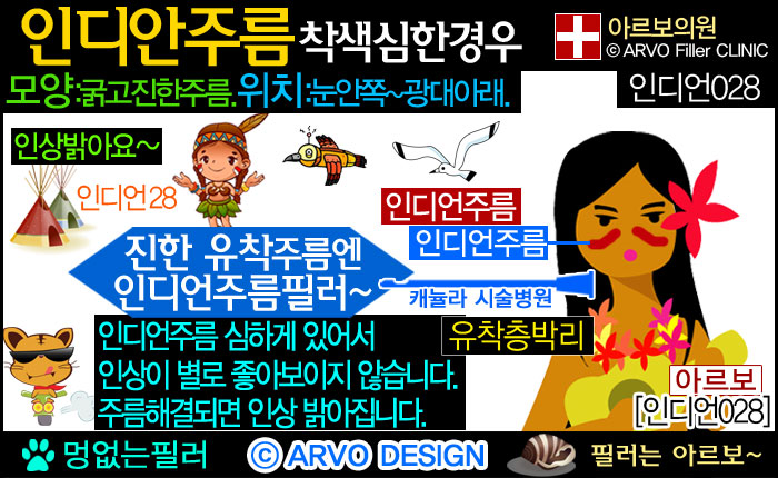 눈밑꺼짐,눈밑꺼짐필러,눈밑필러,인디언주름,인디언주름필러