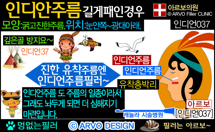 눈밑꺼짐,눈밑꺼짐필러,눈밑필러,인디언주름,인디언주름필러