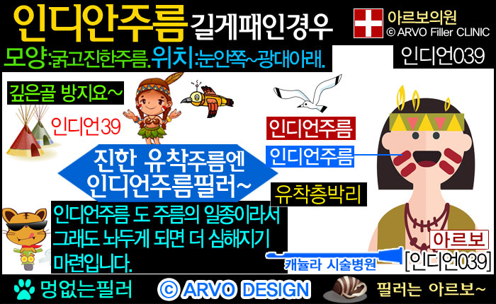눈밑꺼짐,눈밑꺼짐필러,눈밑필러,인디언주름,인디언주름필러39-1