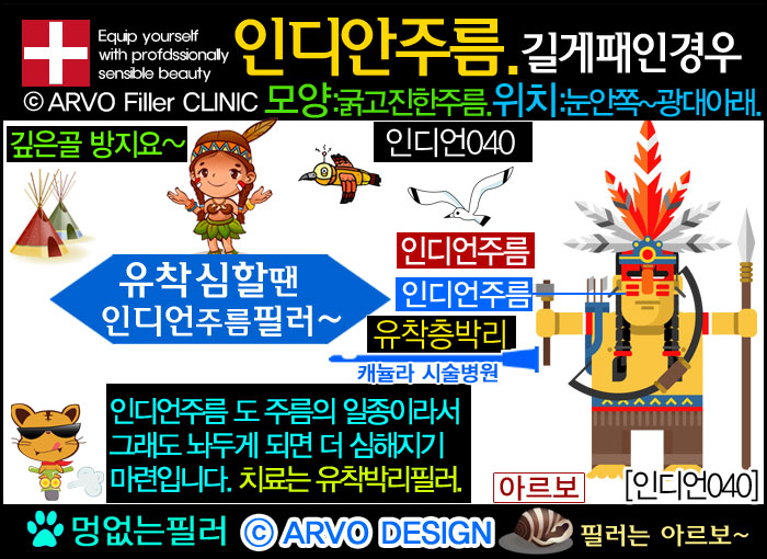 눈밑꺼짐,눈밑꺼짐필러,눈밑필러,인디언주름,인디언주름필러40-3