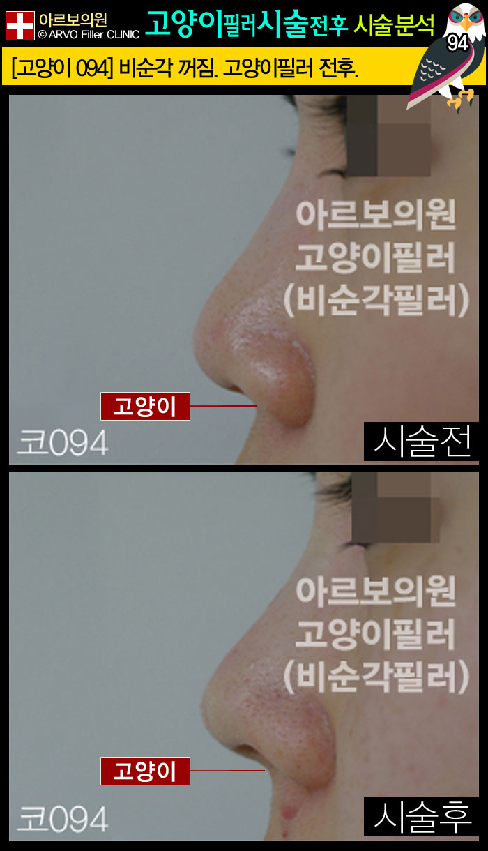 ������ʷ�,�����ʷ�,�������ʷ�,�����̼���,�����̽ü� ,�������ʷ�ȿ��,�����̼�������ȿ��,�����̼���,�ڼ���ȿ��