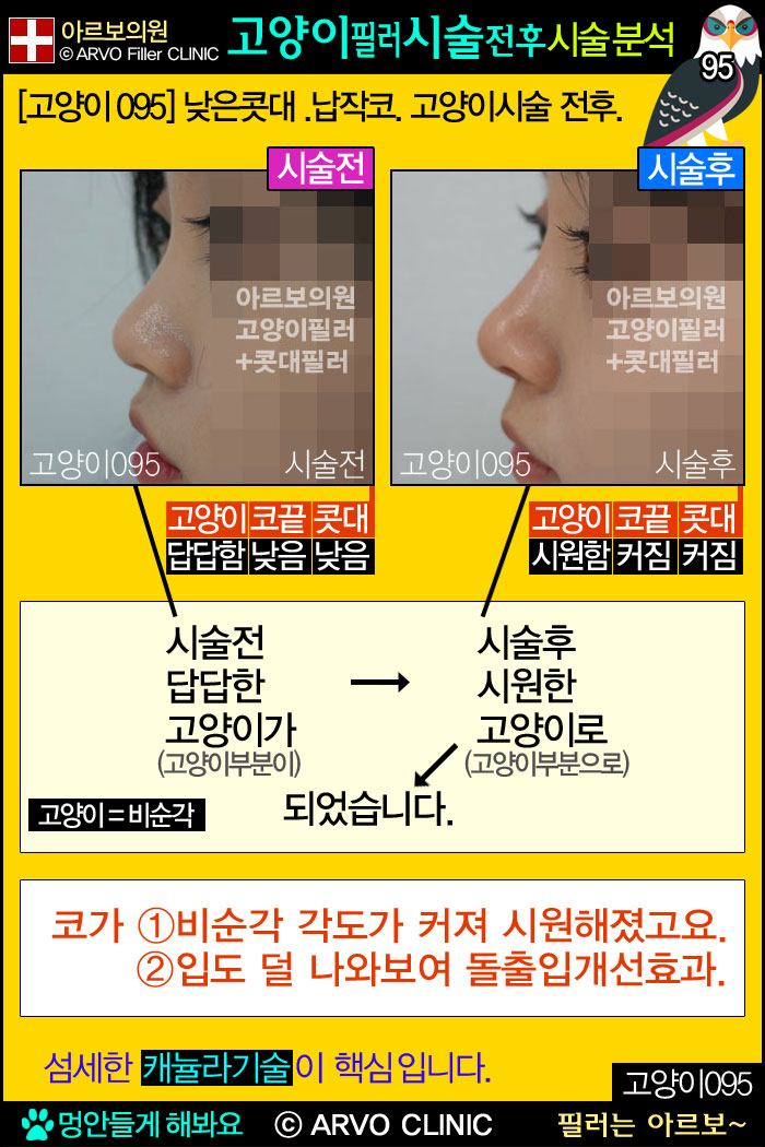 ������ʷ�,�����ʷ�,�������ʷ��ü�����