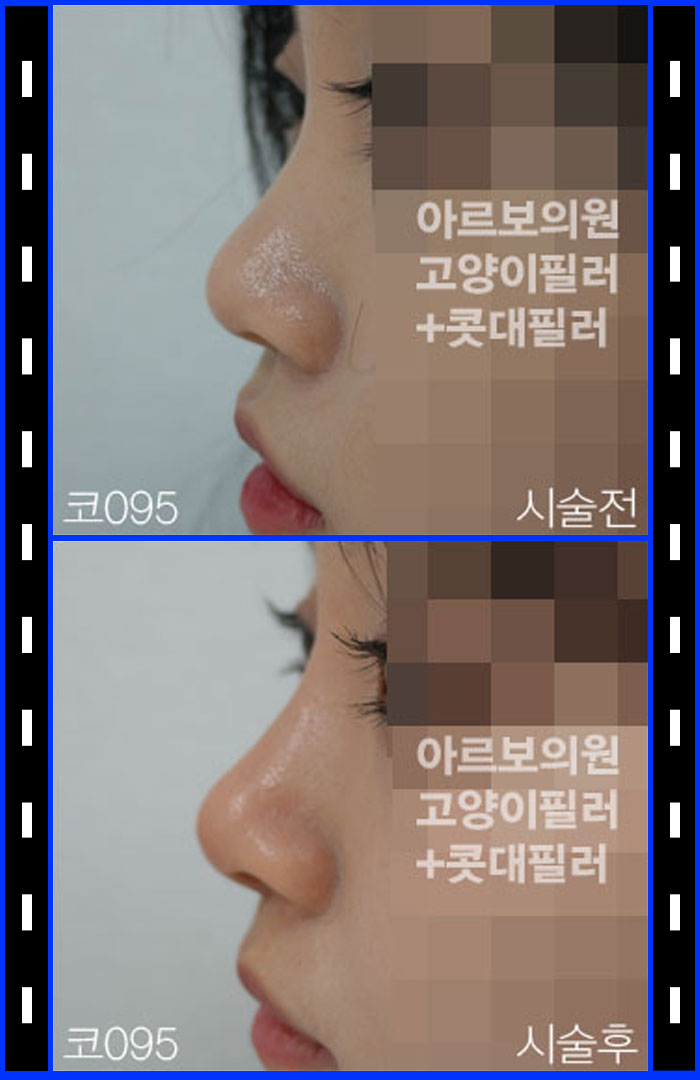 �����ʷ�,���ز���,��ũ��Ŭ