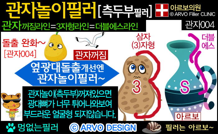 관자놀이꺼짐,더블에스라인,삼자라인,3자라인,삼자형라인,3자형라인,관자놀이필러,관자노리필러,윗광대필러,광대위필러,옆이마필러,측두부필러