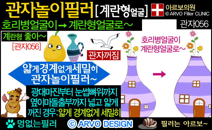 계란형얼굴,호리병,관자놀이필러,관자노리필러,윗광대필러,광대위필러,옆이마필러,측두부필러