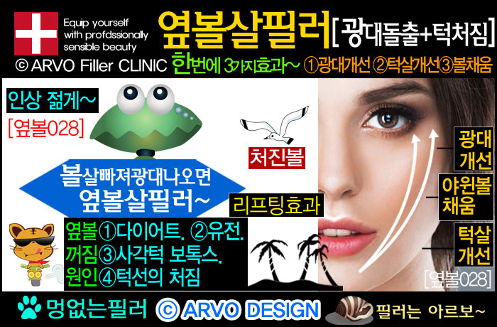 볼리프팅,리프팅필러,볼살필러,볼필러,옆볼살필러,옆광대필러,광대돌출,옆광대돌출,턱살처짐,턱처짐,볼처짐,볼살처짐