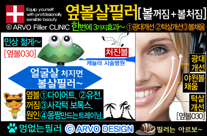 볼리프팅,리프팅필러,볼살필러,볼필러,옆볼살필러,옆광대필러,광대돌출,옆광대돌출,턱살처짐,턱처짐,볼처짐