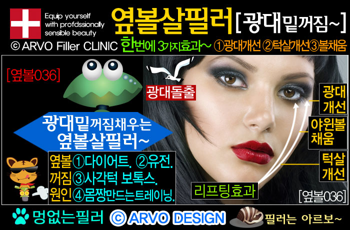 볼살필러,볼필러,옆볼살필러,옆광대필러,광대돌출,옆광대돌출,턱살처짐,턱처짐,볼처짐