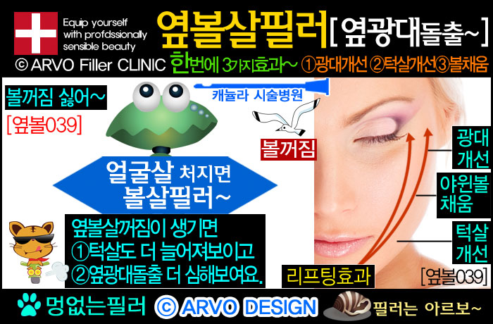 볼살필러,볼필러,옆볼살필러,옆광대필러,광대돌출,옆광대돌출,턱살처짐,턱처짐,볼처짐