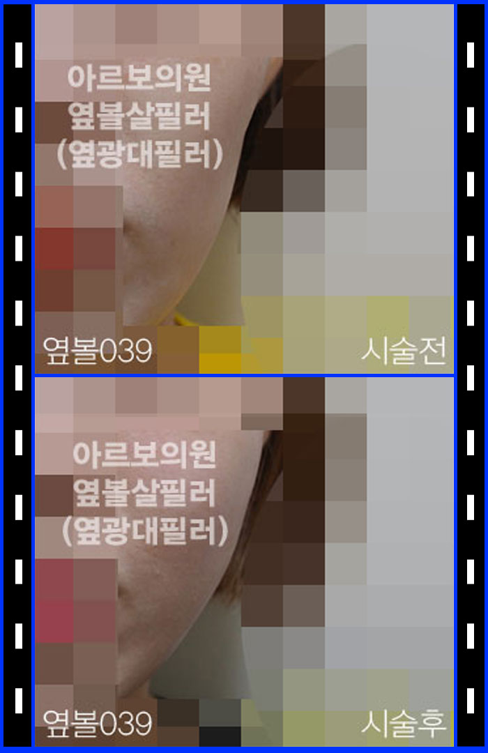 ʷ,ʷ
