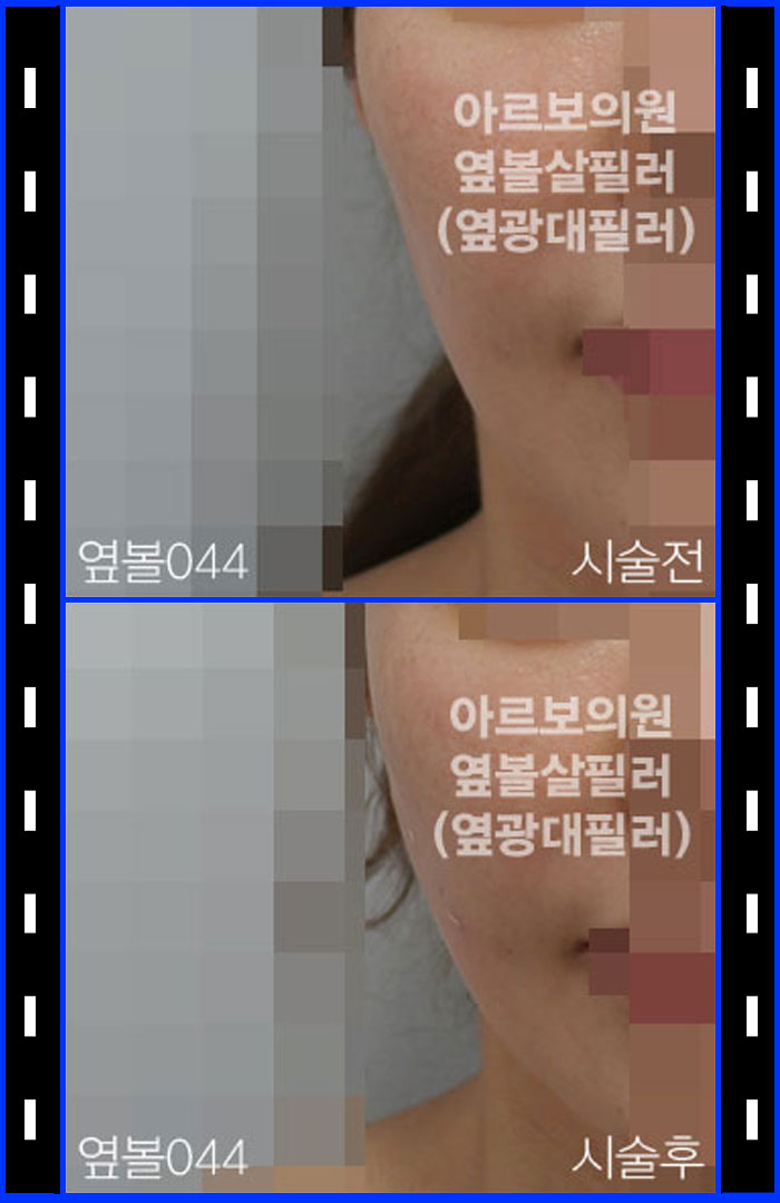 ʷ,ʷ