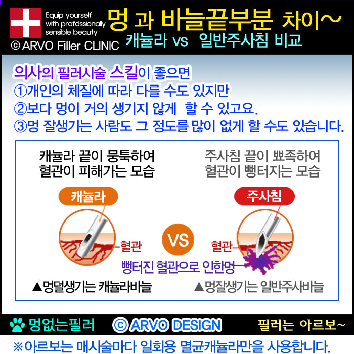 캐뉼라바늘끝 비교